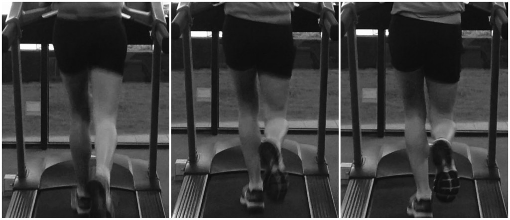 3 images highlighting likely weakness through the left  Glute Medius. As the bodyweight is transferred onto the left leg the pelvis progressively drops towards the right indicating weakness.